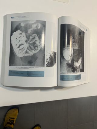 Bases anatómicas del diagnóstico por imagen (Sp...