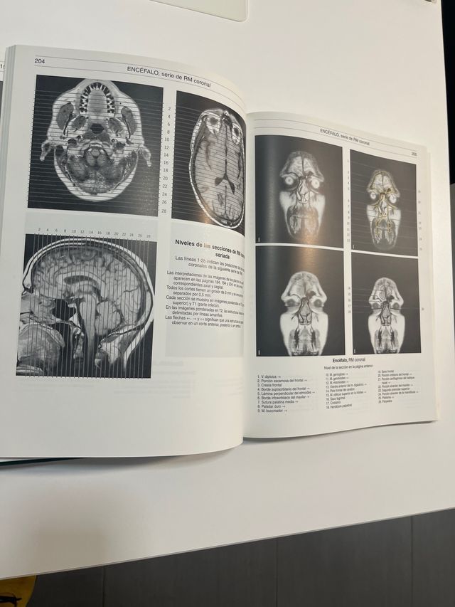 Bases anatómicas del diagnóstico por imagen (Sp...