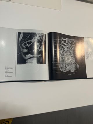 Bases anatómicas del diagnóstico por imagen (Sp...