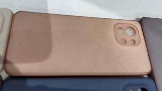 5 Fundas Xiaomi Mi 11