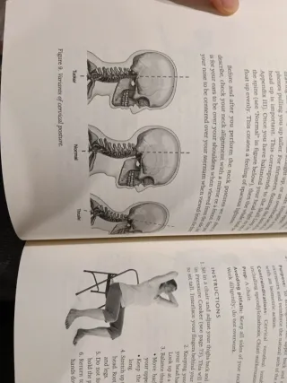 Yoga para Artritis: Guía Completa