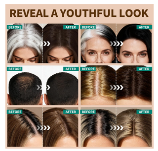 KIMUSE Polvere Copri-Radici Capelli Castani