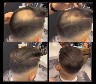 x5 Toppik Dark Brown – Fibras Capilares