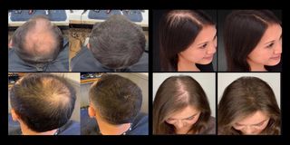 x3 Toppik Fibras Capilares Marrón Oscuro