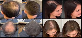 x2 Toppik Dark Brown – Fibras Capilares