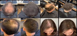 x1 Toppik Dark Brown – Fibras Capilares