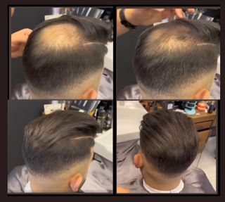 x2 Toppik Dark Brown + Aplicador Fibras Capilares