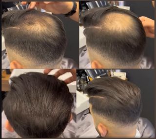 x2 Toppik Marrón Medio + x1 Aplicador