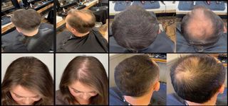 x2 Toppik Marrón Medio + x1 Aplicador