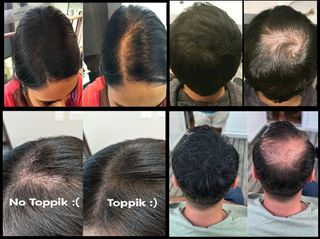 x1 Toppik Marrón Medio + x1 Aplicador