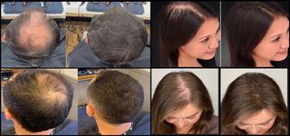 x3 Toppik Fibras Capilares Marrón Oscuro