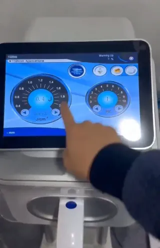 Máquina Láser Picosegundo