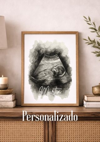 Lámina personalizada Ecografía Bebé