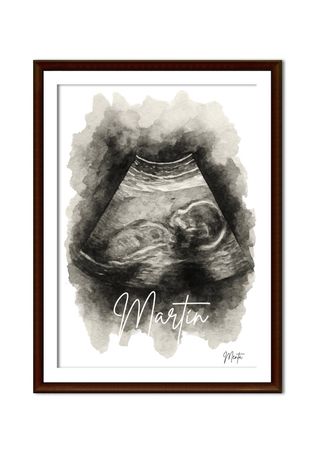 Lámina personalizada Ecografía Bebé