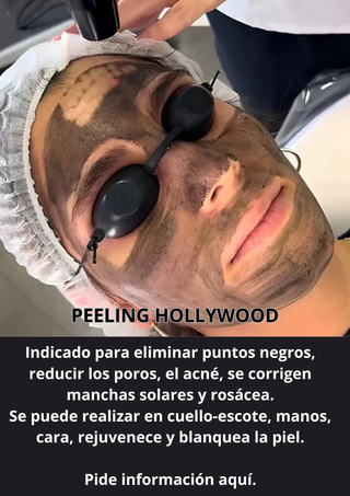 Peeling de carbono, eliminación tatuajes y microp.