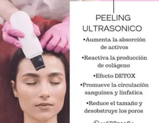 Peeling Ultrasónico Facial - Limpieza Profunda