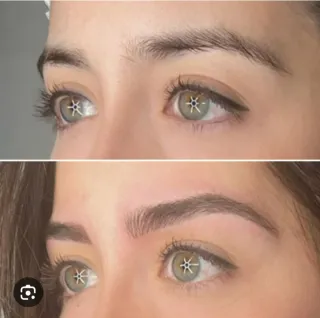 Se realiza microblanding