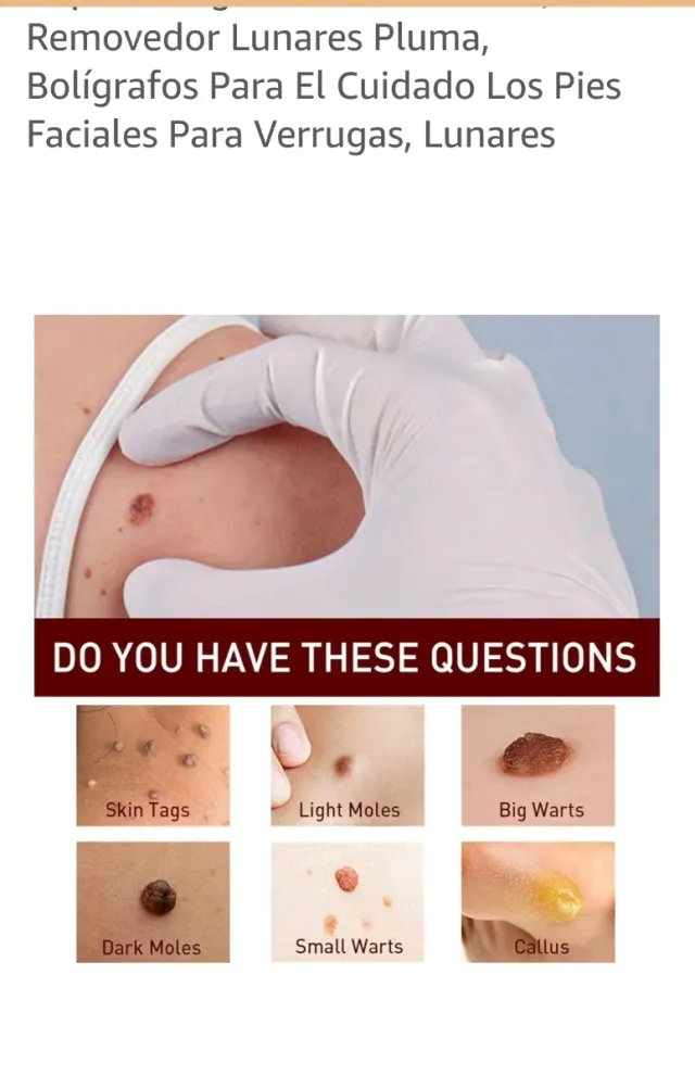 Jaysuing Rimuovi Liquido Verruche 3ml