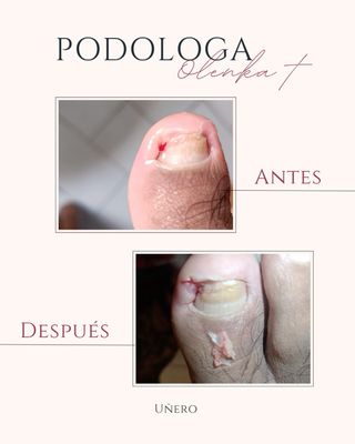 Sono specialista in piedi pulizia profonda.