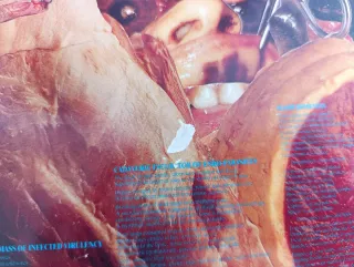 Carcass - Symphonies Of Sickness Vinilo