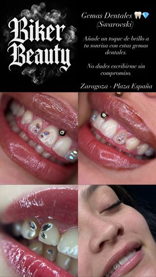 GEMAS DENTALES / ZARAGOZA