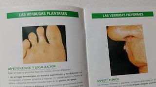 Las Verugas , Guia de Las Verugas