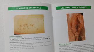 Las Verugas , Guia de Las Verugas