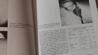 Fracturas del Extremo Distal del Radio