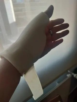 Prótesis mano izquierda dedo gordo