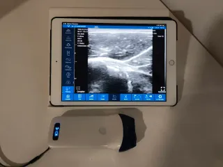 Sonda Eco Portátil USB