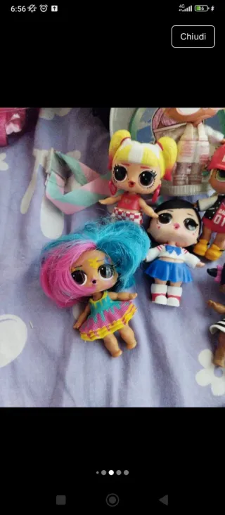 L.O.L. Surprise Bambole
