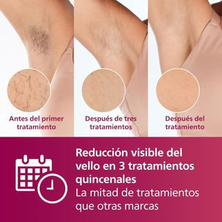 - Philips Lumea Serie 7000, Depiladora Luz Pulsa