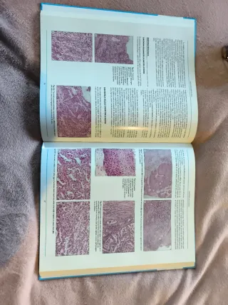 Libro di oncologia ginecologica