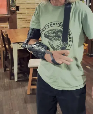 Prótesis de codo ajustable