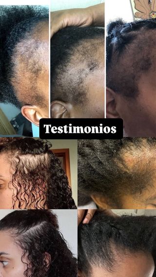 Aceite para Crecimiento Cabello - Natural