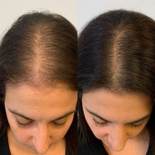 Aceite para Crecimiento Cabello - Natural