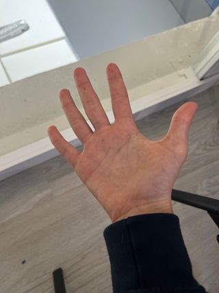 Mano abierta con marcas