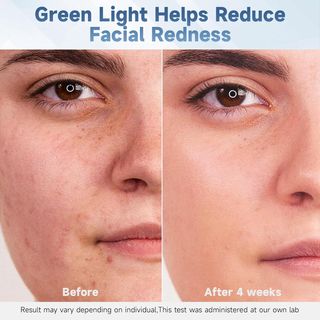 Mascarilla Facial LED 7 Colores