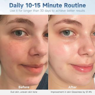 Mascarilla Facial LED 7 Colores