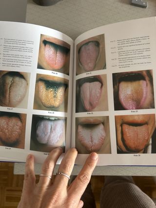 Diagnóstico por la lengua en medicina china.