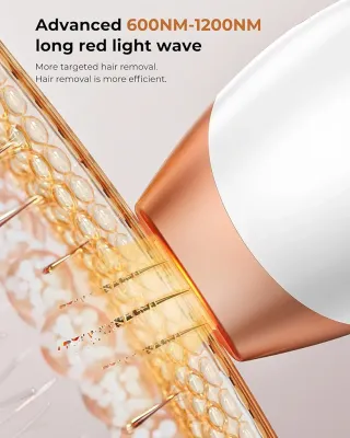 Depiladora IPL Portátil