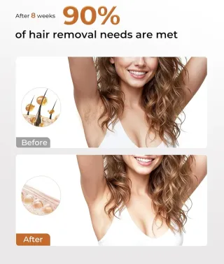 Depiladora IPL Portátil