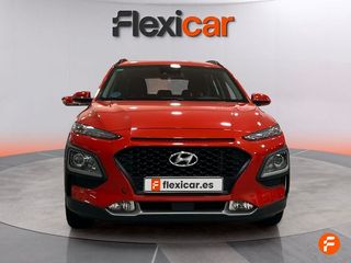 Hyundai Kona 1.0 TGDi Essence 4x2