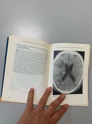 La neurología para atención primaria en 100 imá...