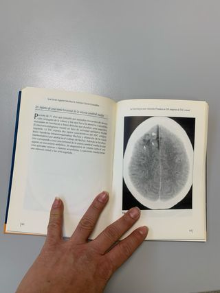 La neurología para atención primaria en 100 imá...