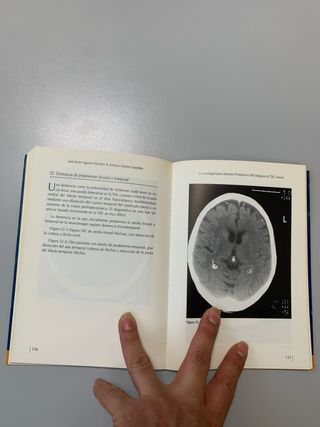 La neurología para atención primaria en 100 imá...