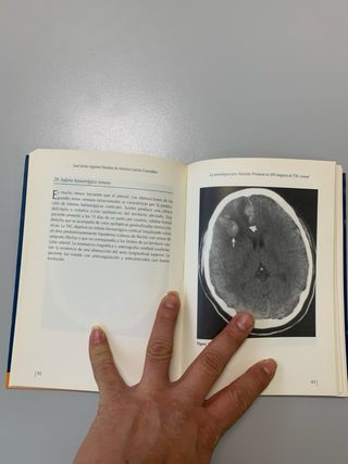 La neurología para atención primaria en 100 imá...