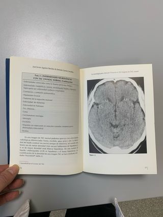 La neurología para atención primaria en 100 imá...