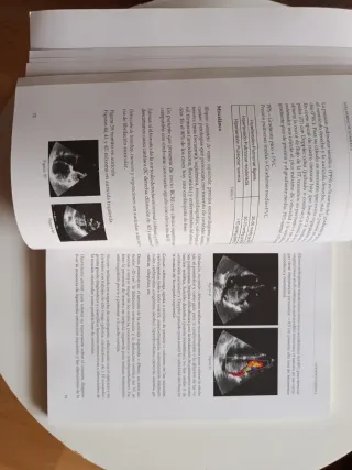 Libro "Ecografía en Atención Primaria" SAMFyC