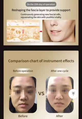 Máquina HIFU 7D Nueva